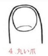丸い爪