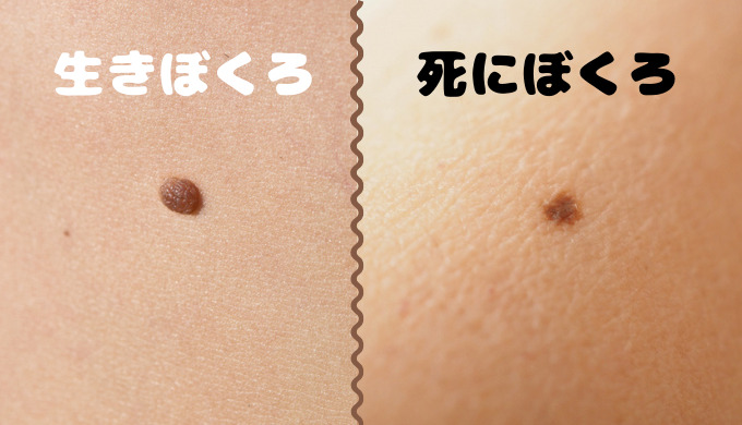 生きぼくろ死にぼくろ違い